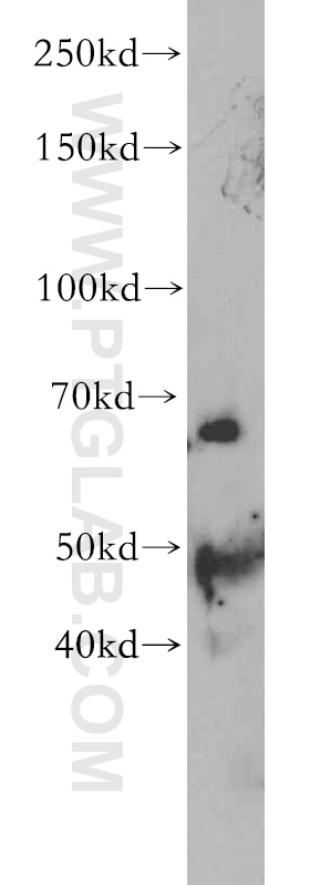 Western Blot (WB) analysis of human placenta tissue using SLC22A15 Polyclonal antibody (20626-1-AP)