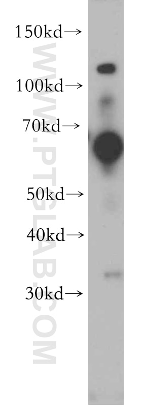 Western Blot (WB) analysis of human heart tissue using SLC22A15 Polyclonal antibody (20626-1-AP)