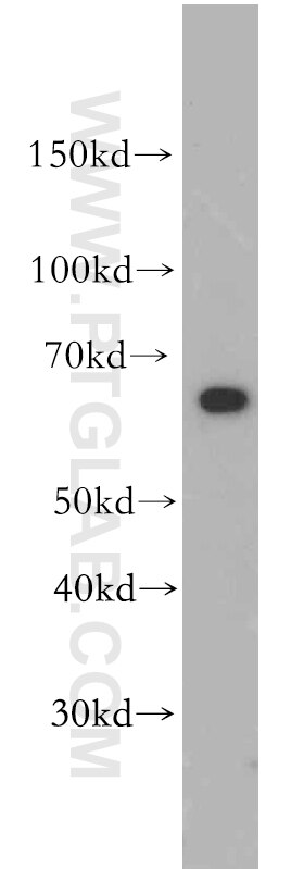 Western Blot (WB) analysis of human brain tissue using SLC22A15 Polyclonal antibody (20626-1-AP)