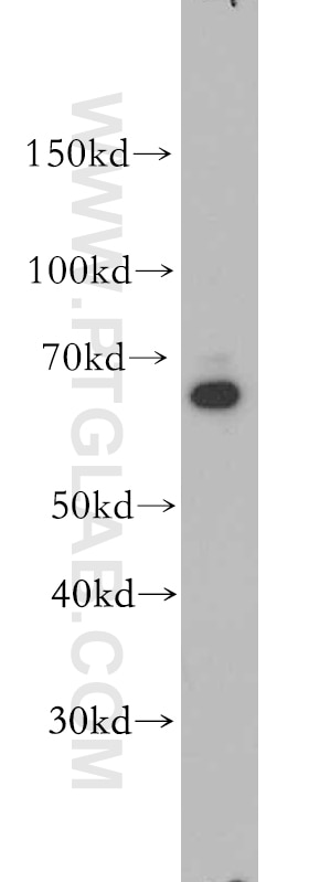 Western Blot (WB) analysis of HEK-293 cells using SLC22A15 Polyclonal antibody (20626-1-AP)