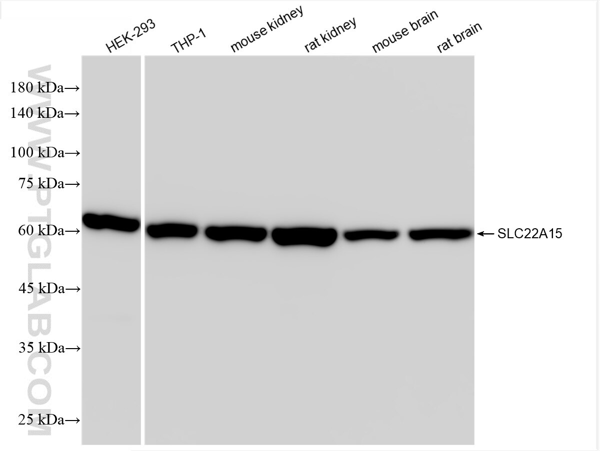 Western Blot (WB) analysis of various lysates using SLC22A15 Recombinant antibody (85960-1-RR)