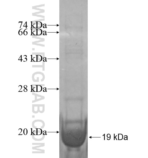 SLC22A15 fusion protein Ag14531 SDS-PAGE