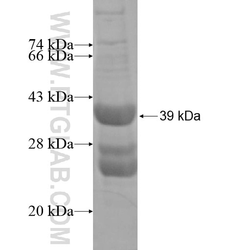 SLC22A15 fusion protein Ag14547 SDS-PAGE
