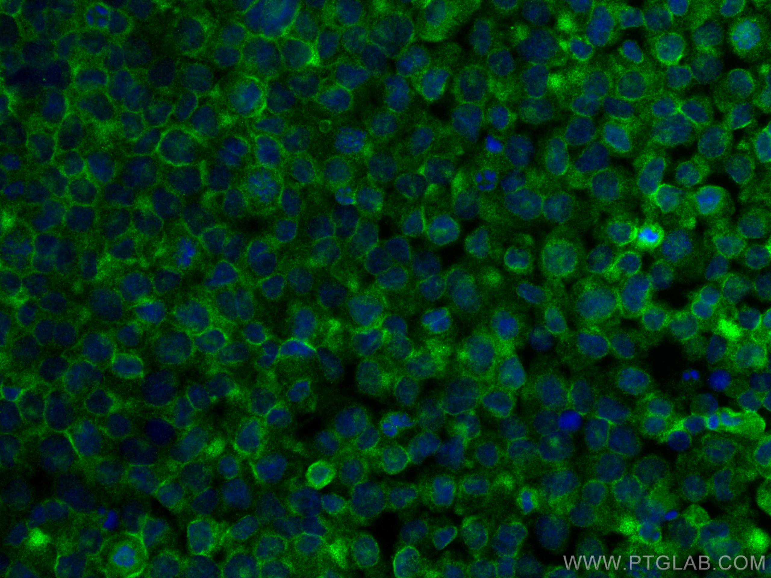 Immunofluorescence (IF) / fluorescent staining of THP-1 cells using SLC22A16 Polyclonal antibody (26833-1-AP)
