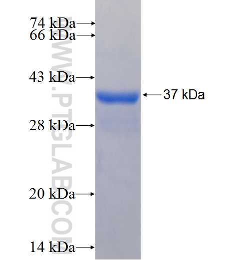 SLC22A16 fusion protein Ag25270 SDS-PAGE