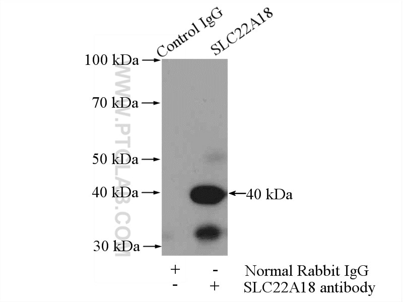 Immunoprecipitation (IP) experiment of mouse brain tissue using SLC22A18 Polyclonal antibody (11646-2-AP)