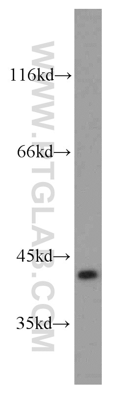 Western Blot (WB) analysis of mouse brain tissue using SLC22A18 Polyclonal antibody (11646-2-AP)