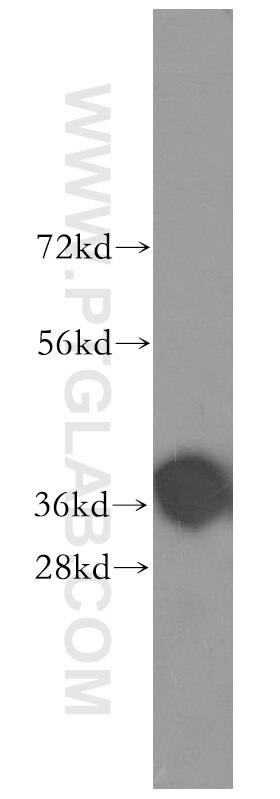 Western Blot (WB) analysis of COLO 320 cells using SLC22A18 Polyclonal antibody (11646-2-AP)