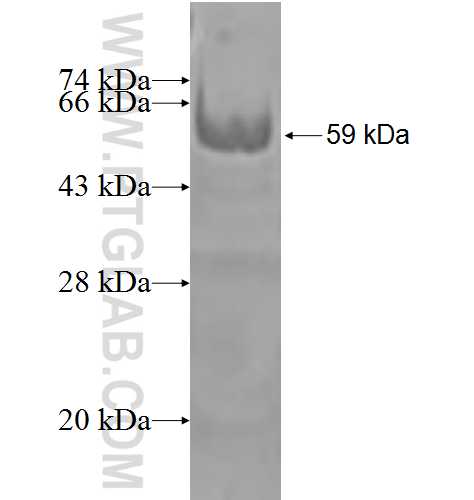 SLC22A18 fusion protein Ag2245 SDS-PAGE