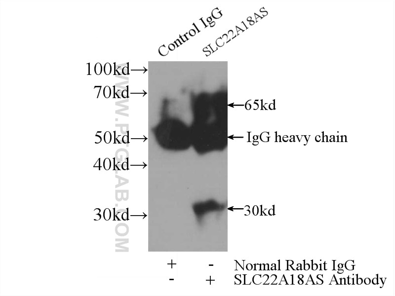 Immunoprecipitation (IP) experiment of HepG2 cells using SLC22A18AS Polyclonal antibody (13475-1-AP)