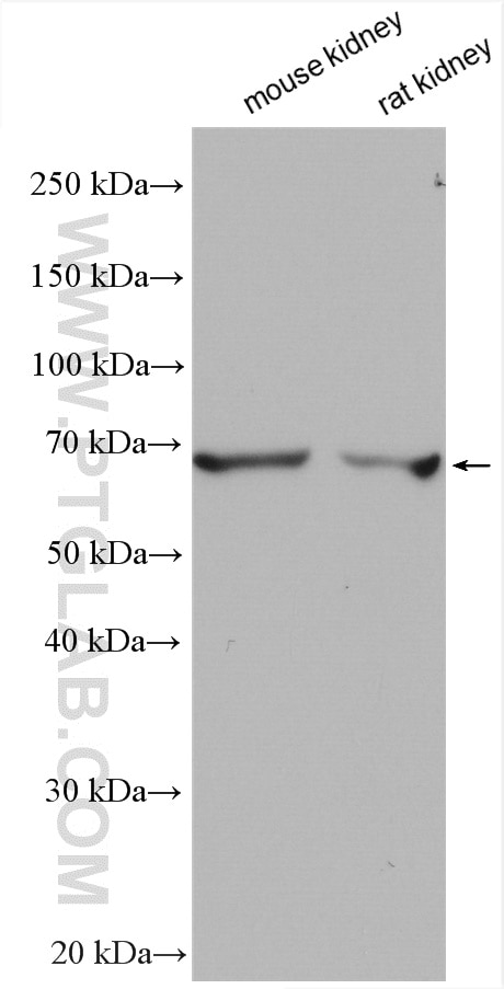 Western Blot (WB) analysis of various lysates using SLC22A2 Polyclonal antibody (13594-1-AP)