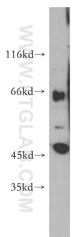 Western Blot (WB) analysis of HEK-293 cells using SLC22A2 Polyclonal antibody (13594-1-AP)