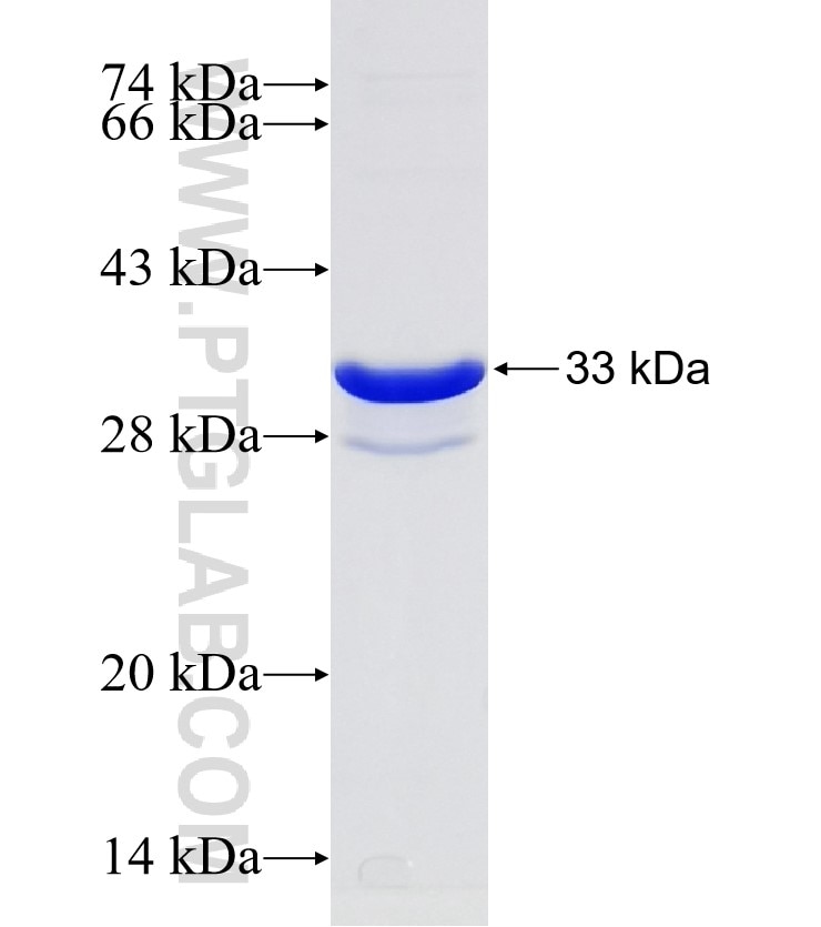 SLC22A2 fusion protein Ag31255 SDS-PAGE