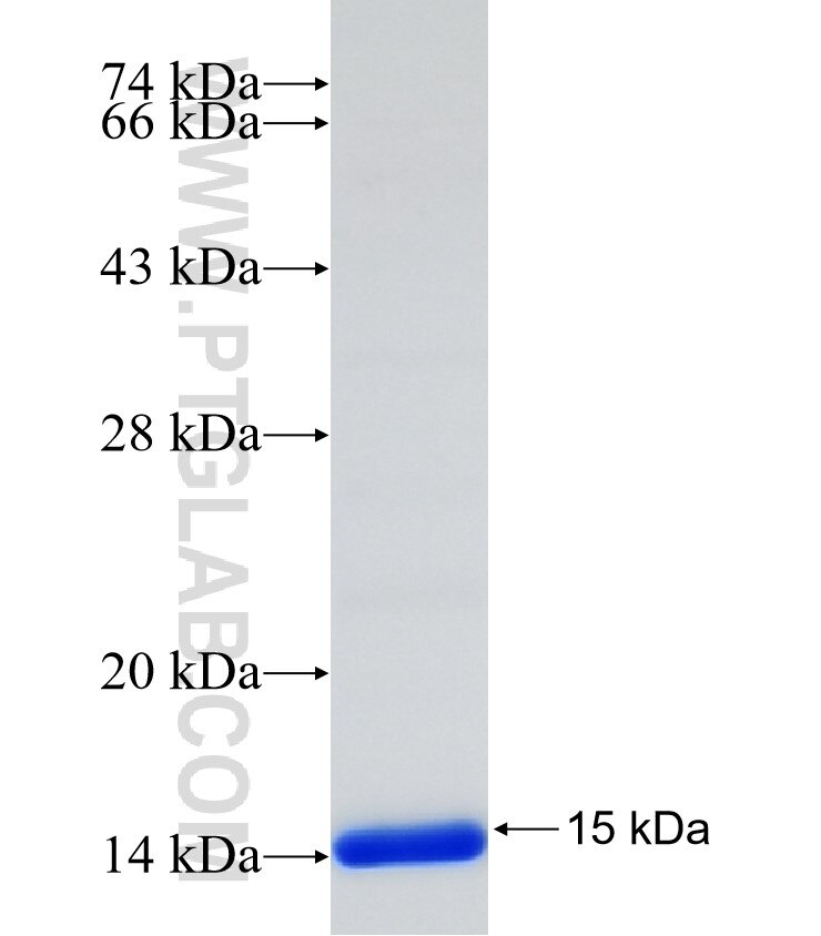 SLC22A2 fusion protein Ag31271 SDS-PAGE
