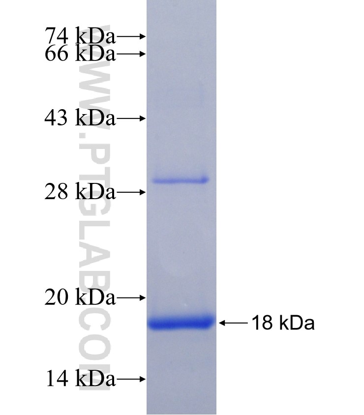 SLC22A2 fusion protein Ag4968 SDS-PAGE