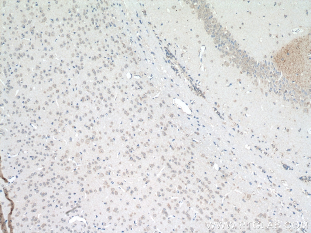 Immunohistochemistry (IHC) staining of mouse brain tissue using SLC22A23 Polyclonal antibody (24901-1-AP)