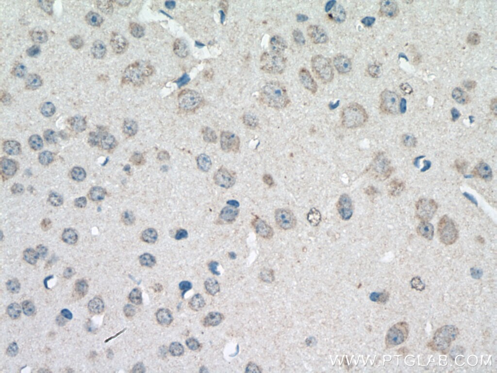 Immunohistochemistry (IHC) staining of mouse brain tissue using SLC22A23 Polyclonal antibody (24901-1-AP)