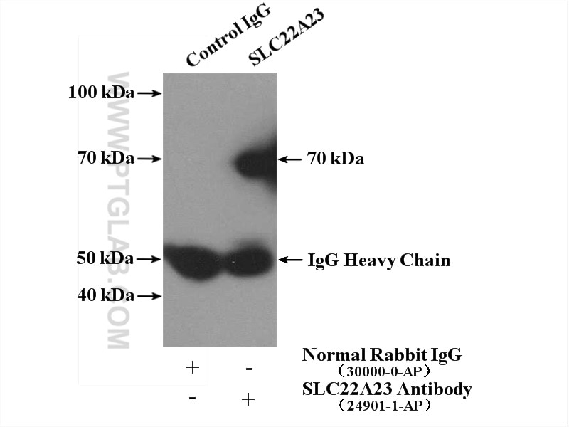 Immunoprecipitation (IP) experiment of mouse liver tissue using SLC22A23 Polyclonal antibody (24901-1-AP)