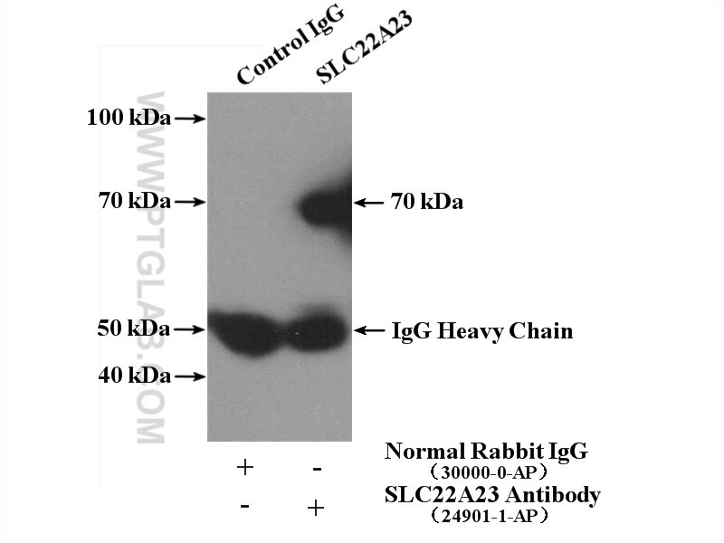 Immunoprecipitation (IP) experiment of mouse liver tissue using SLC22A23 Polyclonal antibody (24901-1-AP)