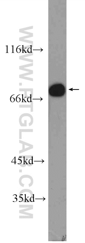 Western Blot (WB) analysis of L02 cells using SLC22A23 Polyclonal antibody (24901-1-AP)