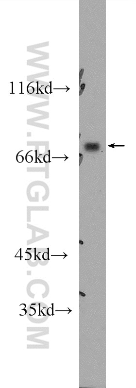 Western Blot (WB) analysis of mouse liver tissue using SLC22A23 Polyclonal antibody (24901-1-AP)