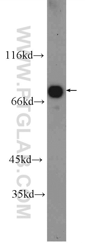 Western Blot (WB) analysis of rat liver tissue using SLC22A23 Polyclonal antibody (24901-1-AP)