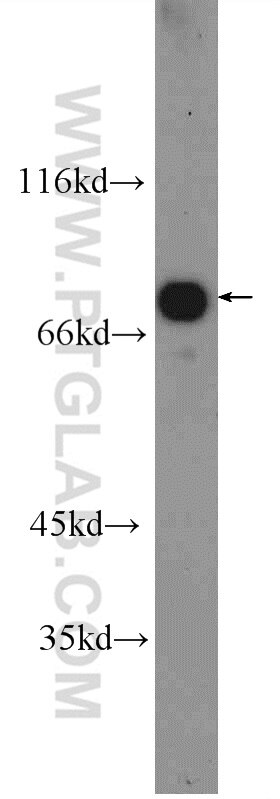 Western Blot (WB) analysis of rat liver tissue using SLC22A23 Polyclonal antibody (24901-1-AP)