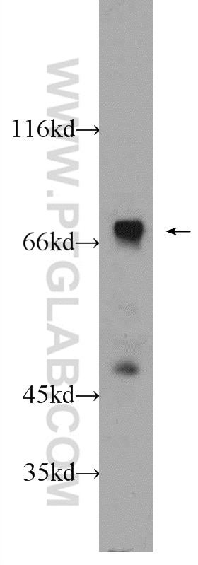 Western Blot (WB) analysis of mouse kidney tissue using SLC22A23 Polyclonal antibody (24901-1-AP)