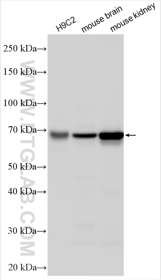 Western Blot (WB) analysis of various lysates using SLC22A24 Polyclonal antibody (20834-1-AP)