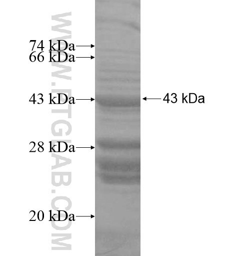 SLC22A24 fusion protein Ag14907 SDS-PAGE