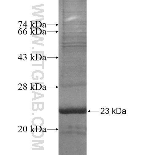 SLC22A24 fusion protein Ag15466 SDS-PAGE