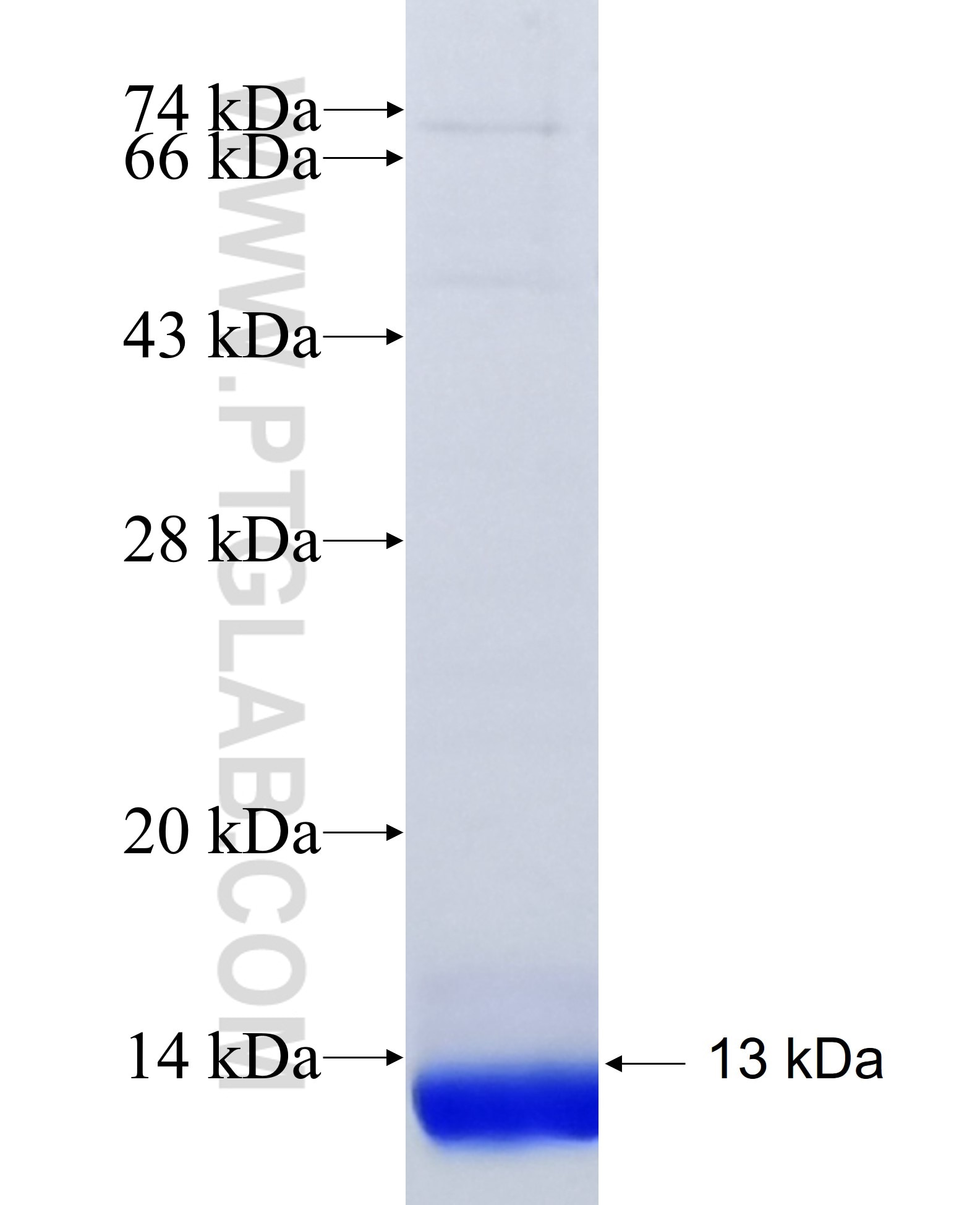 SLC22A25 fusion protein Ag35042 SDS-PAGE SLC22A25 fusion protein Ag35042 SDS-PAGE