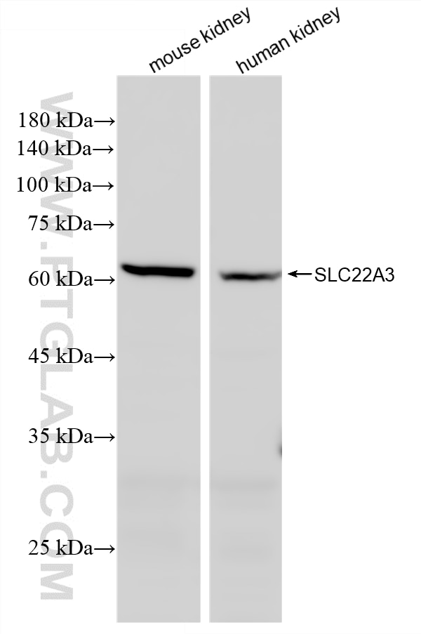 Western Blot (WB) analysis of various lysates using SLC22A3 Recombinant monoclonal antibody (87757-1-RR)
