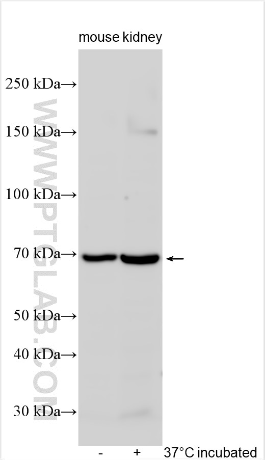 Western Blot (WB) analysis of various lysates using SLC22A4 Polyclonal antibody (13238-1-AP)