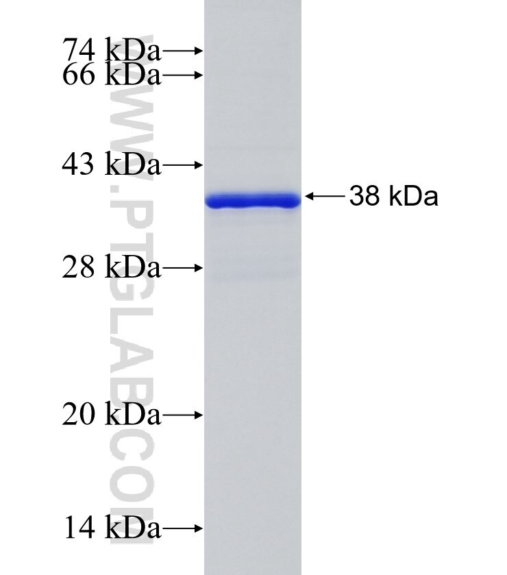 SLC22A4 fusion protein Ag3974 SDS-PAGE