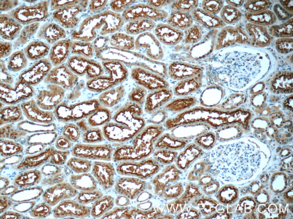 IHC staining of human kidney using 16331-1-AP