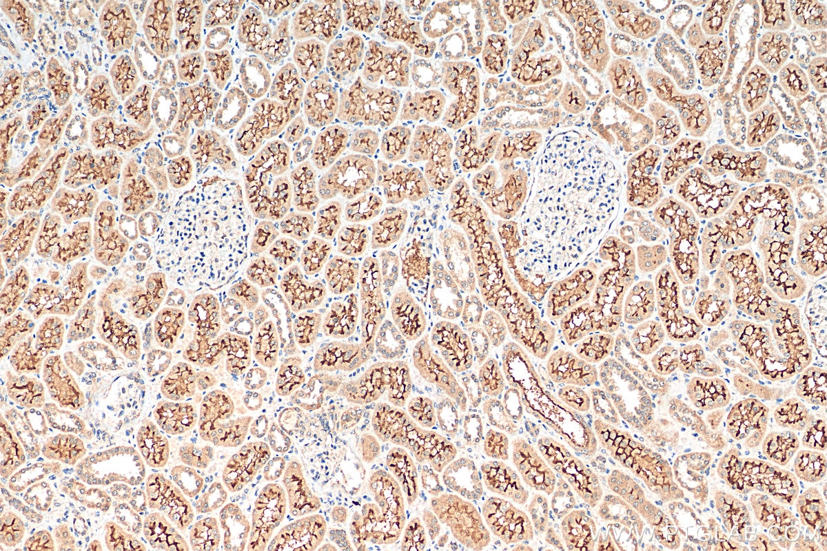Immunohistochemistry (IHC) staining of human kidney tissue using OCTN2 Polyclonal antibody (16331-1-AP)