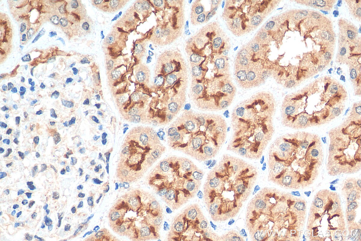 Immunohistochemistry (IHC) staining of human kidney tissue using OCTN2 Polyclonal antibody (16331-1-AP)