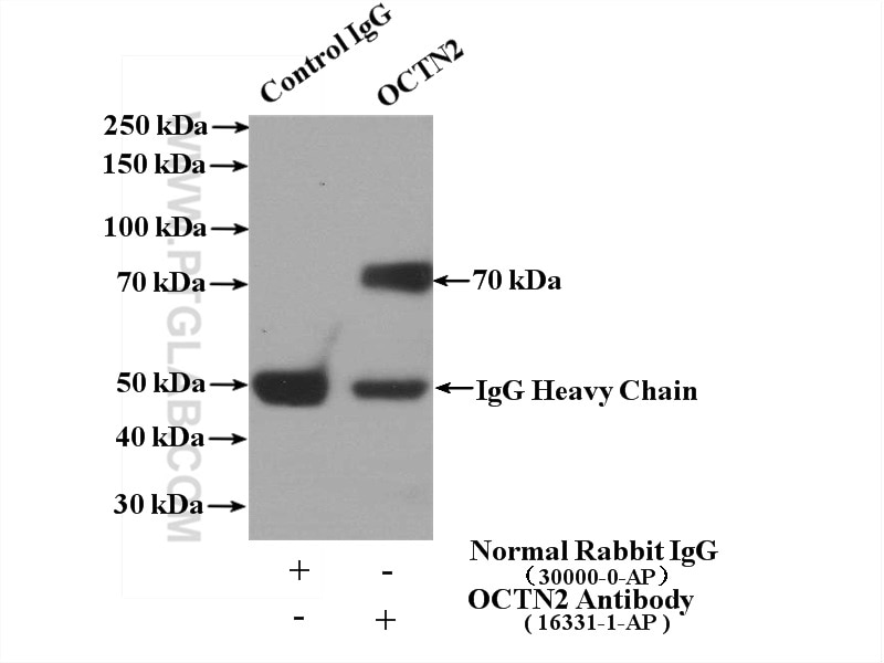 Immunoprecipitation (IP) experiment of mouse skeletal muscle tissue using OCTN2 Polyclonal antibody (16331-1-AP)