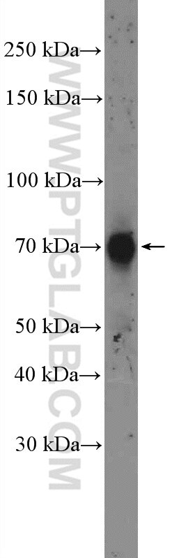 Western Blot (WB) analysis of mouse testis tissue using OCTN2 Polyclonal antibody (16331-1-AP)