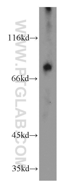 Western Blot (WB) analysis of mouse small intestine tissue using OCTN2 Polyclonal antibody (16331-1-AP)