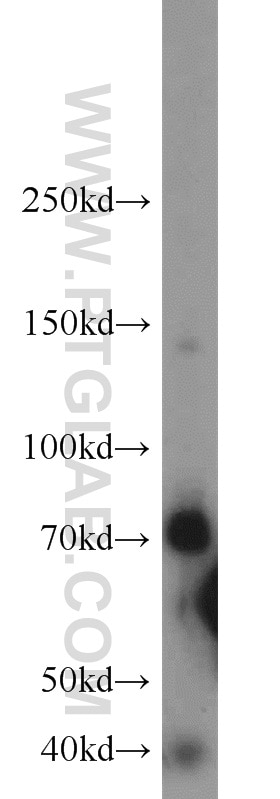 Western Blot (WB) analysis of mouse skeletal muscle tissue using OCTN2 Polyclonal antibody (16331-1-AP)