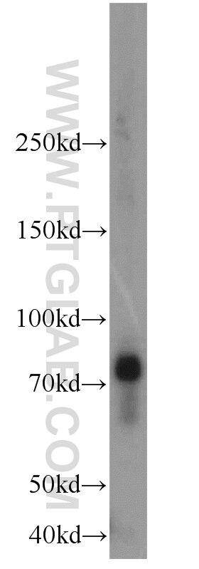 Western Blot (WB) analysis of human placenta tissue using OCTN2 Polyclonal antibody (16331-1-AP)