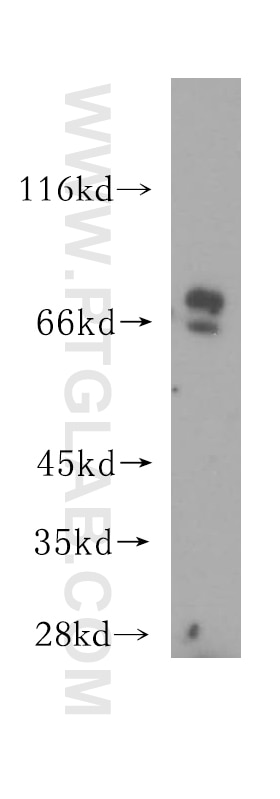 Western Blot (WB) analysis of mouse pancreas tissue using OCTN2 Polyclonal antibody (16331-1-AP)