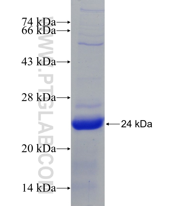 SLC22A5 fusion protein Ag9684 SDS-PAGE