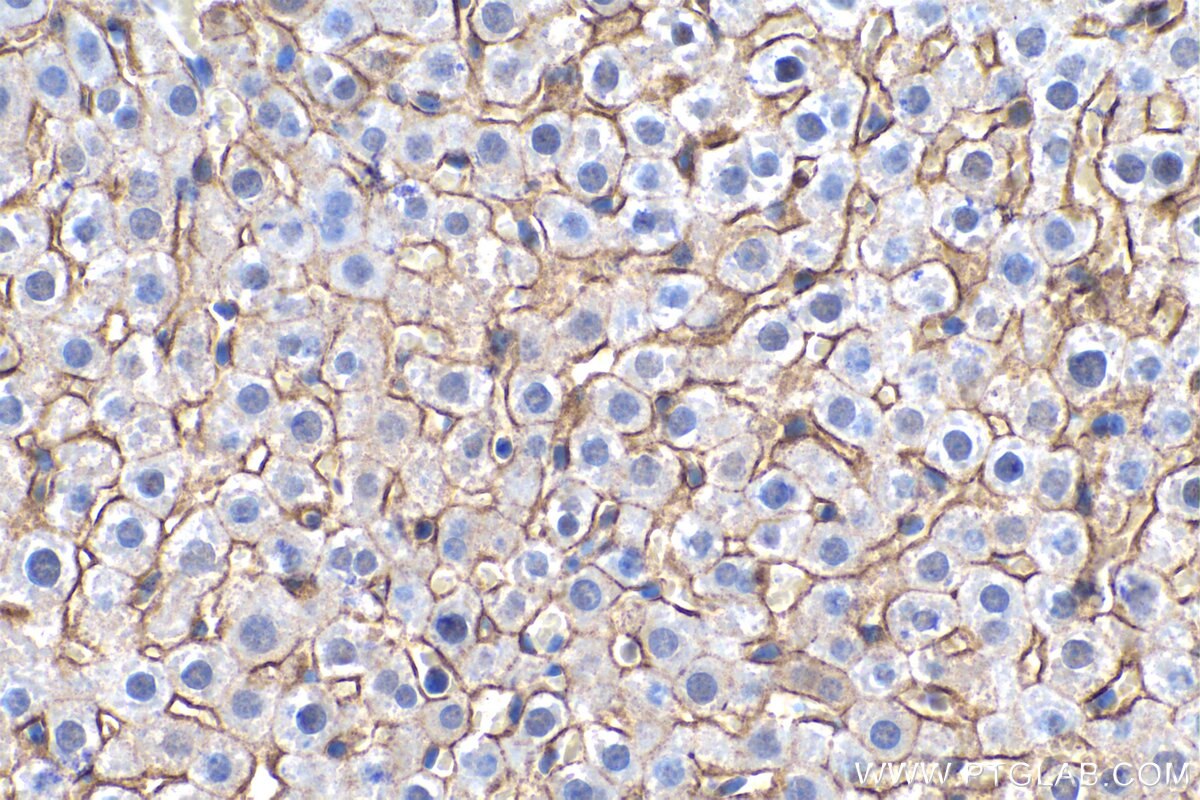 Immunohistochemistry (IHC) staining of mouse liver tissue using SLC22A7 Polyclonal antibody (26796-1-AP)