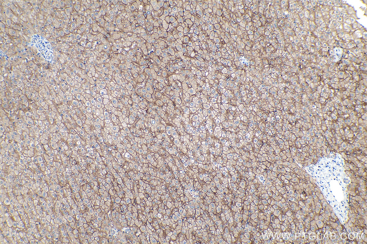 Immunohistochemistry (IHC) staining of human liver tissue using SLC22A7 Polyclonal antibody (26796-1-AP)