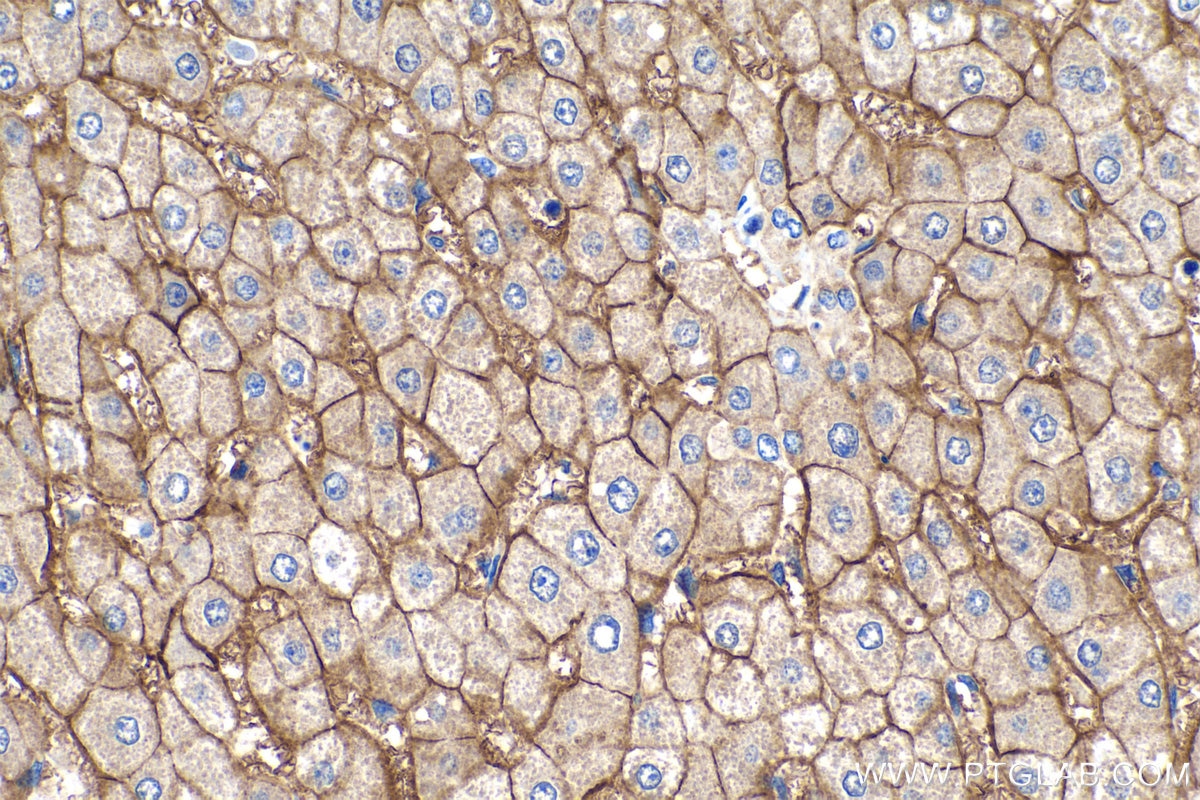 Immunohistochemistry (IHC) staining of human liver tissue using SLC22A7 Polyclonal antibody (26796-1-AP)