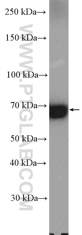 Western Blot (WB) analysis of mouse kidney tissue using SLC22A7 Polyclonal antibody (26796-1-AP)