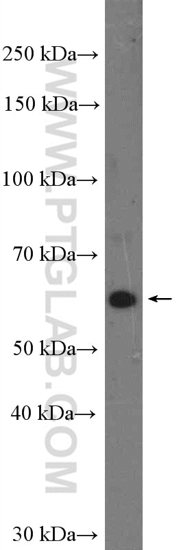 Western Blot (WB) analysis of HEK-293 cells using SLC22A7 Polyclonal antibody (26796-1-AP)